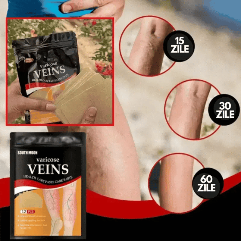 Plasturi Anti-Varice cu Turmeric