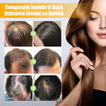 Ser cu Biotină pentru creșterea rapidă a părului
